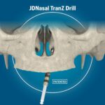 JDNasal TranZ Drill LONG JDDIADRL101