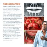 2-Day Full Arch Treatment Course - Image 3