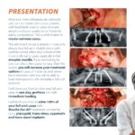 2-Day Maxilla For All Course - Image 3