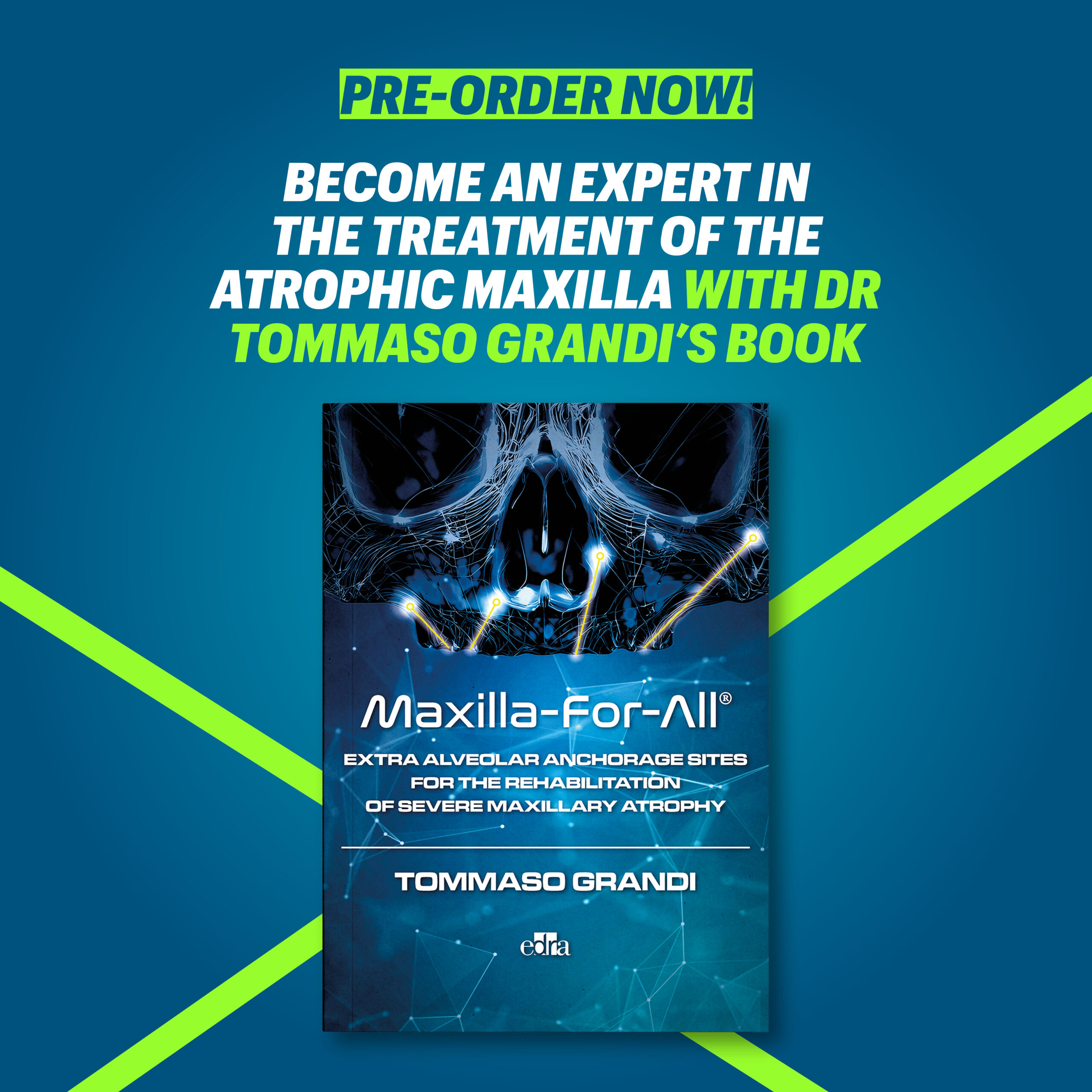 Libro_Maxilla-For-All_Grandi7 Maxilla For All Book by Dr Tomasso Grandi - Image 1